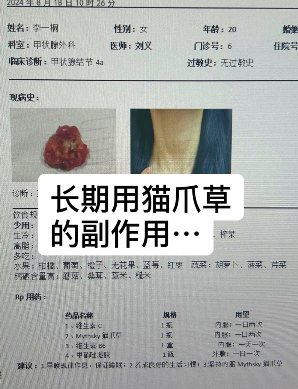 消肿散结,改进淋巴结难题
